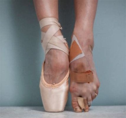 Do Ballet Dancers Have Bad Feet? A Detailed Exploration